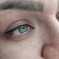 آموزشگاه خدمات فوق تخصصی چهره ها