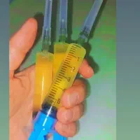 ناپدید شدن شپش ورشک فقط باهمین سرنگا