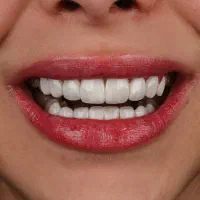 تمامی خدمات دندانپزشکی با تعرفه دولتی