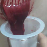 حجامت . برداشت خال توسط پزشک