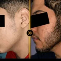 مرد شو