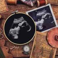 قاب گلدوزی سونوگرافی