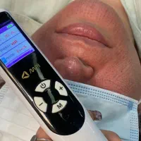 دستگاه لیزر، کربن تراپی، ریمو تتو، دستگاه سم زدایی|پزشکی|سنندج, |دیوار