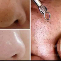 فیشیال کلاسیک