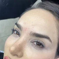 میکروبلیدینگ رایگان