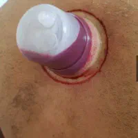 راهنمایی میکنم در زمینه طب|فعالیت داوطلبانه|شیراز, سیاه سنگ|دیوار