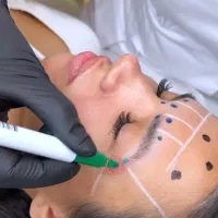 بوتاکس فیلر ژل هایفو نخ پی ار پی مزو  پزشک زیبایی