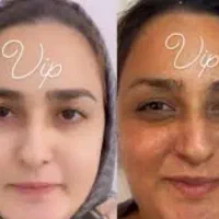 بهترین کرم پوست|آرایشی، بهداشتی، درمانی|کرج, احدآباد|دیوار