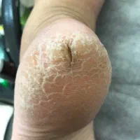 پدیکور پا و پودولوژی