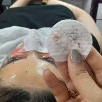 درماپلنینگ وپاکسازی صورت بادستگاه خدمات اموزش فردا