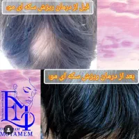 مطب پوست،مو،زیبایی دکتر الهام متمم|خدمات آرایشگری و زیبایی|رشت, گلسار|دیوار