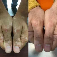 شما هم این مشکل رو دارین آیا