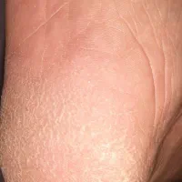 پدیکور کف سابی پا و پارافین تراپی دست صورت