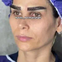 کاشت ابرو تضمینی با خواب طبیعی و آموزش|خدمات آرایشگری و زیبایی|کرمانشاه, |دیوار