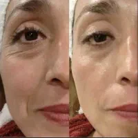 راز جوانسازی با بیوممتیک