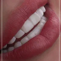 بیمه دندانپزشکی/ارتودنسی/کامپوزیت با نیم بها