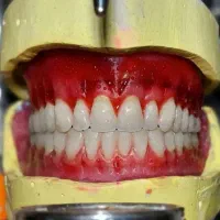 کامپوزیت بدون تراش دندان فکی ۶میلیون|خدمات آرایشگری و زیبایی|قم, شهرک مهدیه|دیوار