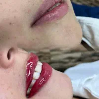 شیدینگ تخصصی لب