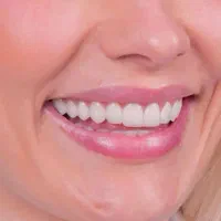 دندانپزشکی تخصصی و تضمینی