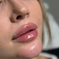 کیلینک زیبایی پاستور تخصصی ترین کیلینک زنجان