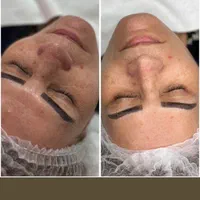 فیشال و پاکسازی کاشت مژه  و لیفت ابرو
