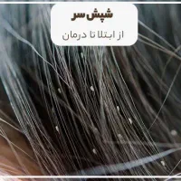 خداحافظی با رشک و شپش