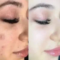 کرم سوپر لاکچری vip
