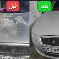رفع آفتاب سوختگی