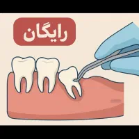 کشیدن دندان عقل