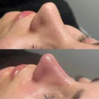 تخفیف آموزش پاکسازی وفیشال به مدت یک ماه|خدمات آموزشی|نیشابور, دارایی|دیوار