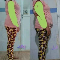 چربی سوزی شکم پهلو|آرایشی، بهداشتی، درمانی|گناباد, |دیوار