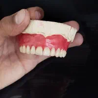 دندانسازی ،پروتر متحرک .دندان مصنوعی|خدمات آرایشگری و زیبایی|کرمانشاه, |دیوار