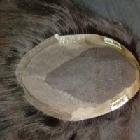 پروتز مو در حد نو