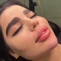 کلینیک تزریق ژل بوتاکس آنزیم فیلر لب شقیقه|خدمات آرایشگری و زیبایی|کرج, گوهردشت|دیوار