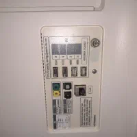 مین بکلایت دیفیوزر 65sj85000