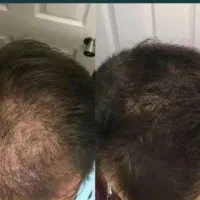با ما دیگه نیازی به کاشت نداری
