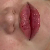 تخفیفات فقط تا ۱۰ اسفندخدمات ب دلیل جابجایی کلینیک