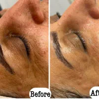 پاکسازی و فیشال درمانی و تخصصی|خدمات آرایشگری و زیبایی|فولادشهر, B4|دیوار