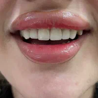 طرح تخفیف لبخند تابستانه