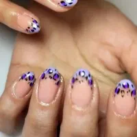 ترمیم و کاشت باقیمت بصرفه وبا کیفیت