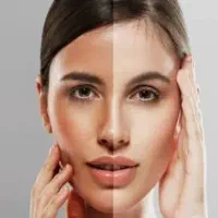 مواد سفید کننده طبیعی پوست را به شما میگم