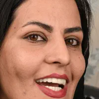 ایمپلنت دندان