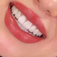 انجام خدمات دندان پزشکی