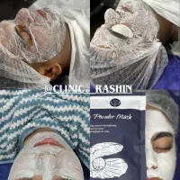 بوتاکس ، فیلر ، مزو، پی آر پی