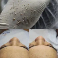 خدمات و آموزش فیشال پوست