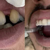 انجام کلیه خدمات دندانپزشکی قرارداد بانک سپه ورفاه|خدمات آرایشگری و زیبایی|فلاورجان, |دیوار