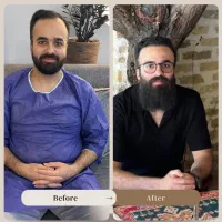 کاشت مو طبیعی با تراکم بالا + مزوتراپی رایگان|خدمات آرایشگری و زیبایی|تهران, شهرک پاسداران|دیوار