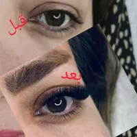 کاشت مژه
