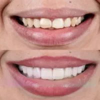 خدمات دندانپزشکی در مطب شخصی