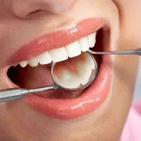 تخفیف فوق العاده عصب کشی